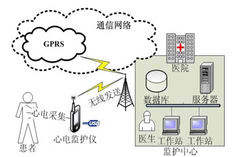 便携式心电监护系统总体框图