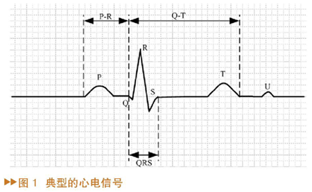 典型的心电信号