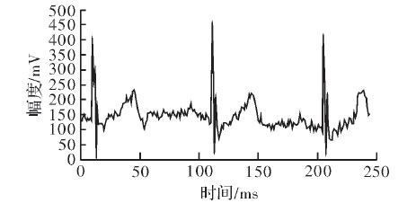 图9 心电波形