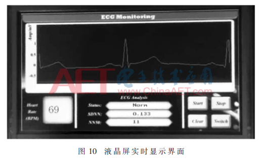 qrs2-t10.gif